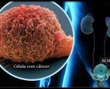 Brasil terá 781 mil novos casos de câncer por ano até 2028, aponta INCA