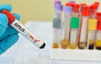 Especialista alerta para proteção contra Sífilis no Carnaval, doença considerada  epidemia nacional