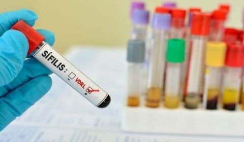 Especialista alerta para proteção contra Sífilis no Carnaval, doença considerada  epidemia nacional