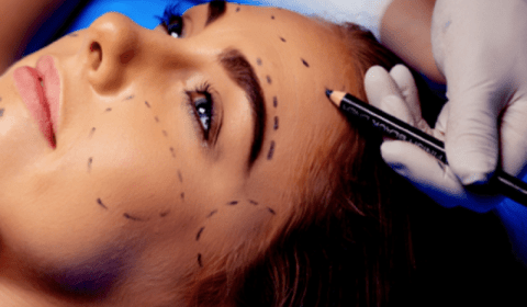 Harmonização facial: saiba quais são as três principais indicações do procedimento