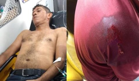 Motorista de ônibus é baleado durante assalto em Manaus