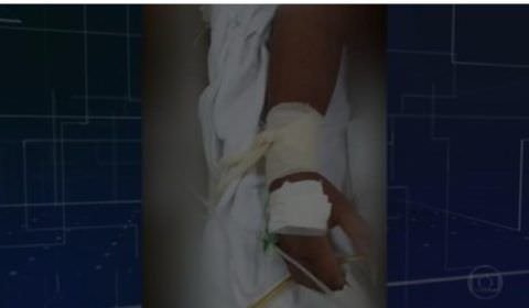 Pacientes com Covid são amarrados a macas no Amazonas por falta de sedativo
