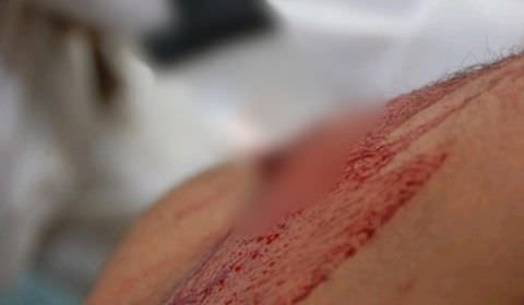 Padrasto é preso por tentar matar enteado à facadas em Manaus