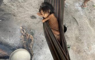 Foto de criança em Roraima expõe crise na assistência à saúde dos yanomamis