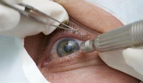 Pandemia faz cair detecção precoce de glaucoma