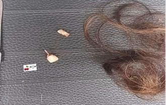 Mulher tem cabelo cortado, dois dentes quebrados e fica mantida em cárcere por nove horas