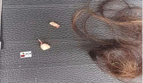 Mulher tem cabelo cortado, dois dentes quebrados e fica mantida em cárcere por nove horas