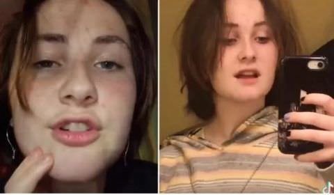 Adolescente de 14 anos posta vídeo no TikTok horas antes de matar sua irmã deficiente