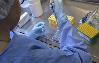Ministério da Saúde aprova compra de 53 mil novos testes para diagnosticar a tuberculose assintomática