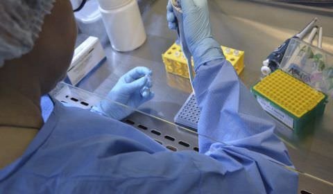 Ministério da Saúde aprova compra de 53 mil novos testes para diagnosticar a tuberculose assintomática