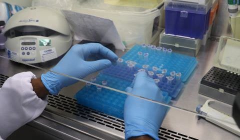 Amazonas tem mais 55 novos casos de Covid-19, aponta FVS-RCP