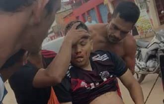 URGENTE: homem leva vários tiros no Cacau Pirera (veja o vídeo)