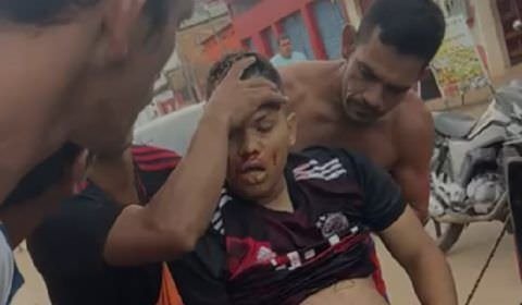 URGENTE: homem leva vários tiros no Cacau Pirera (veja o vídeo)