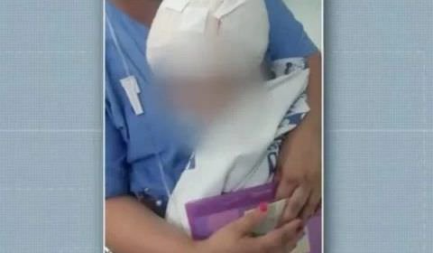 Menina de 2 anos é atacada na cabeça por pit-bull