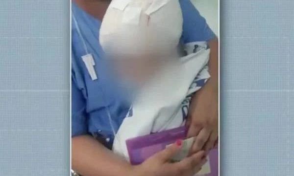 Menina de 2 anos é atacada na cabeça por pit-bull