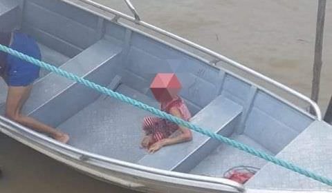 Criança perde todo o couro cabeludo em acidente no rio