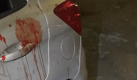 Homem tem corpo estourado na bala por pistoleiro encomendado do CV; veja vídeo