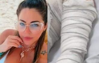 Mulher é presa após tentar matar o vizinho com óleo quente; imagens chocantes