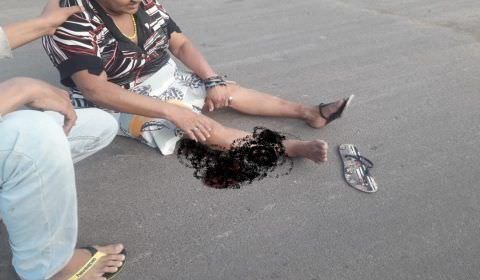 Mulher fratura a perna em acidente em rua de cemitério