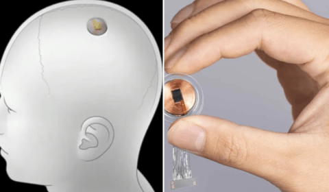 Urgente: empresa quer começar a implantar chips cerebrais em humanos em 2022