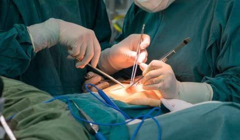 Aumento de 1.604%  no número de amputações de pênis por causa do câncer preocupa