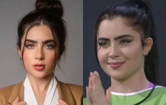 Cirurgião plástico explica rosto inchado de Jade Picon no BBB22