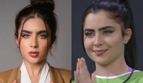 Cirurgião plástico explica rosto inchado de Jade Picon no BBB22