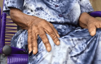 Crueldade: idosa de 103 é espancada por bandidos durante assalto