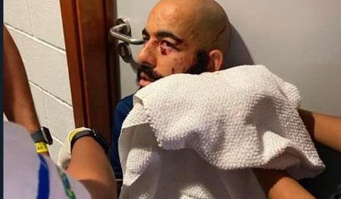Danilo mostra ferimentos após ataque com bombas contra ônibus do Bahia