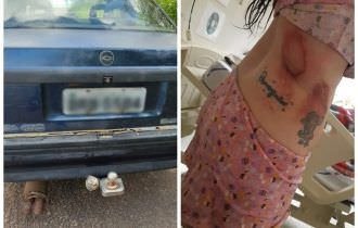 Veja fotos de ferimentos de mulher que foi amarrada por namorado em carro e arrastada