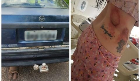 Veja fotos de ferimentos de mulher que foi amarrada por namorado em carro e arrastada