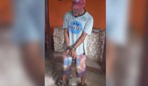 Vídeo: Médico acorrenta funcionário negro e diz: 'vai ficar na minha senzala'