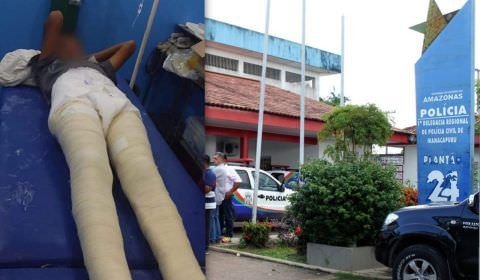 Avô é preso após agredir próprio neto com pedaço de madeira no AM