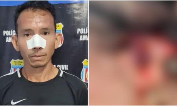 Homem é preso por espancar e cortar parte da orelha da esposa no interior do Amazonas