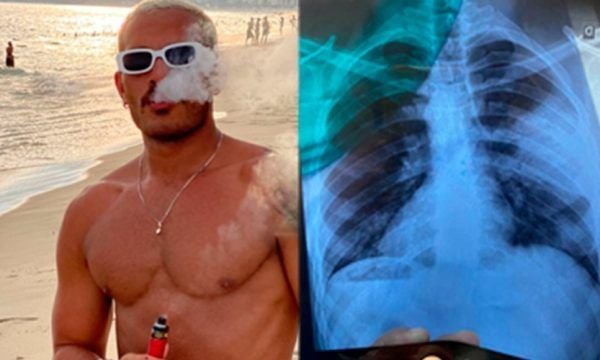 Manauara tem pulmão perfurado por uso de cigarro eletrônico; veja VÍDEO