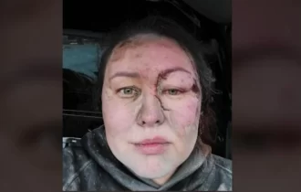 Treinadora ucraniana é "enterrada viva" e choca em meio à guerra