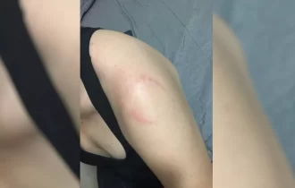 Após tomar suplemento vencido, maromba surta e morde mulher na academia; veja vídeo