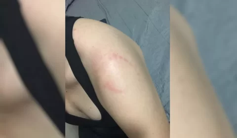 Após tomar suplemento vencido, maromba surta e morde mulher na academia; veja vídeo