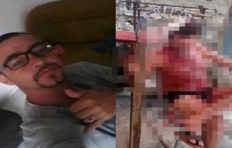 IMAGENS FORTES! Filho agride e quebra a cabeça do próprio pai