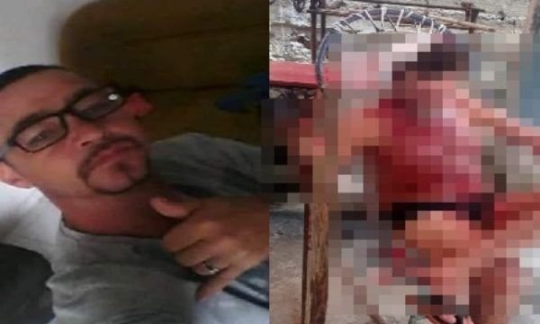 IMAGENS FORTES! Filho agride e quebra a cabeça do próprio pai