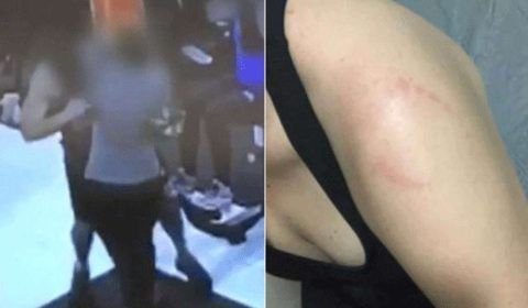 Jovem que foi mordida por homem em academia está assustada: ‘Ele ficava rindo’