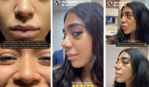 Irmã de Gabigol, chora ao ver resultado de rinoplastia; veja vídeo