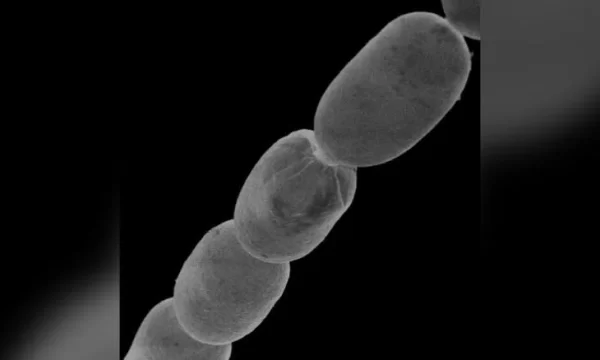 Maior bactéria do mundo é descoberta e cientistas comparam a forma de cílio humano