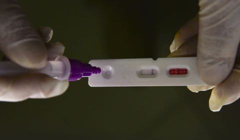 Brasil registra 18,5 mil novos casos e 53 mortes por covid-19