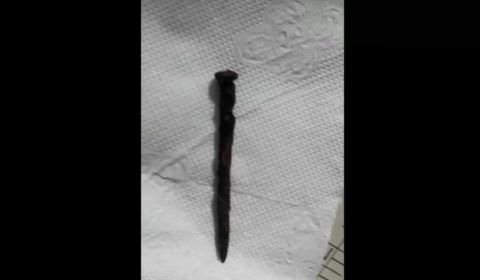Criança morre após ficar 1 ano com prego no pulmão; família vê negligência de hospital