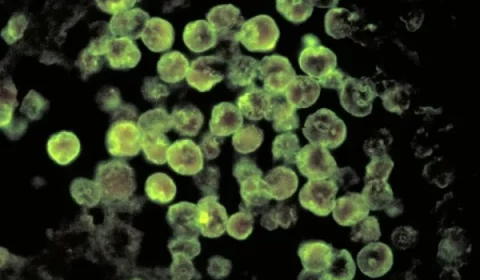 Lago da morte: ameba comedora de cérebro mata homem nos EUA