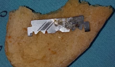 Mulher encontra lâmina dentro de pão de queijo que dividia com bebê