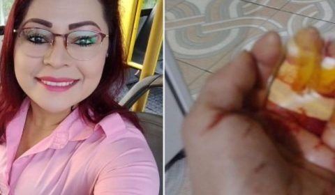 Vídeo: Cobradora é esfaqueada e quase perde os dedos