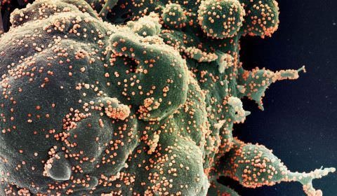 Fiocruz identifica subvariante BA.5.3.1 do coronavírus no Amazonas