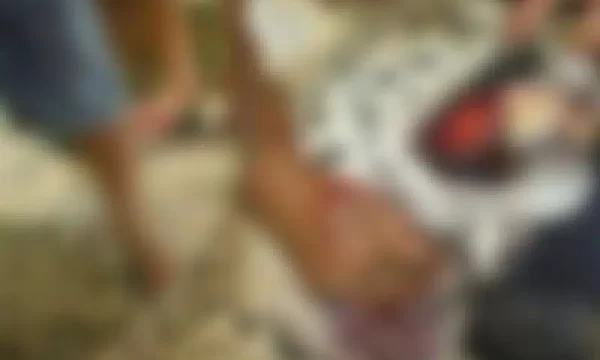 Vídeo: Onça rasga rosto de homem em Iranduba